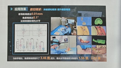 四川医疗创新成果获殊荣，精准科技提升诊疗水平